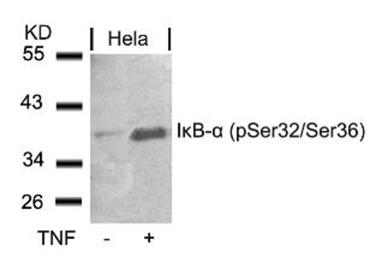 Western blot analysis of lysed extracts from HeLa cells untreated or treated with TNF using I&#954;B-&#945; (Phospho-Ser32/Ser36) .