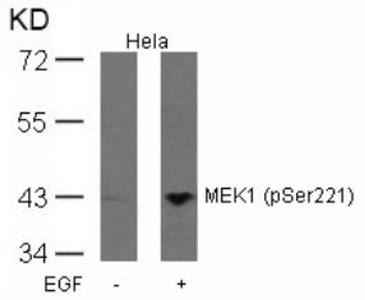 Western blot analysis of lysed extracts from HeLa cells untreated or treated with EGF using MEK1 (Phospho-Ser221) .