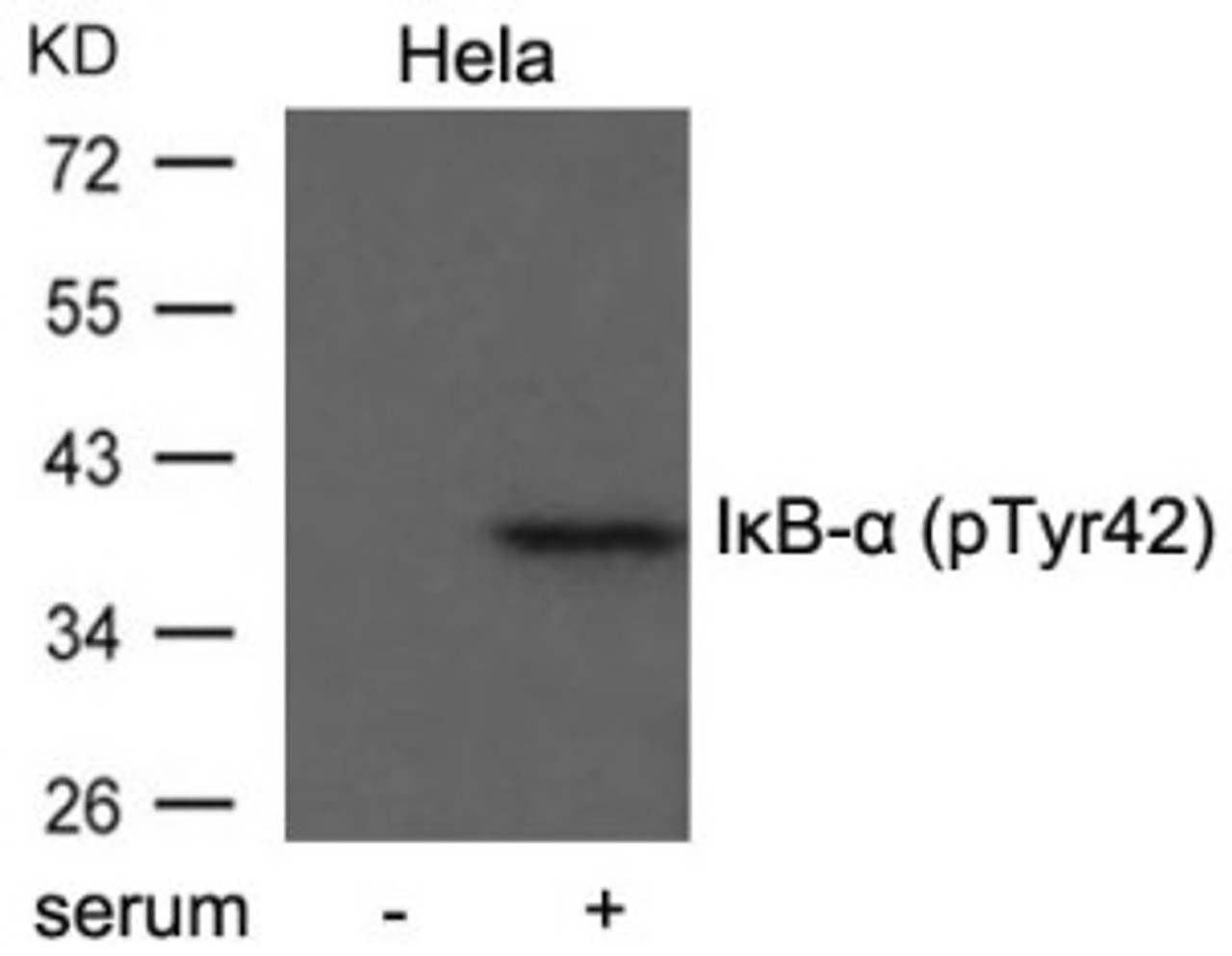 Western blot analysis of extract from HeLa cells untreated or treated with serum using I&#954;B-&#945; (Phospho-Tyr42) .
