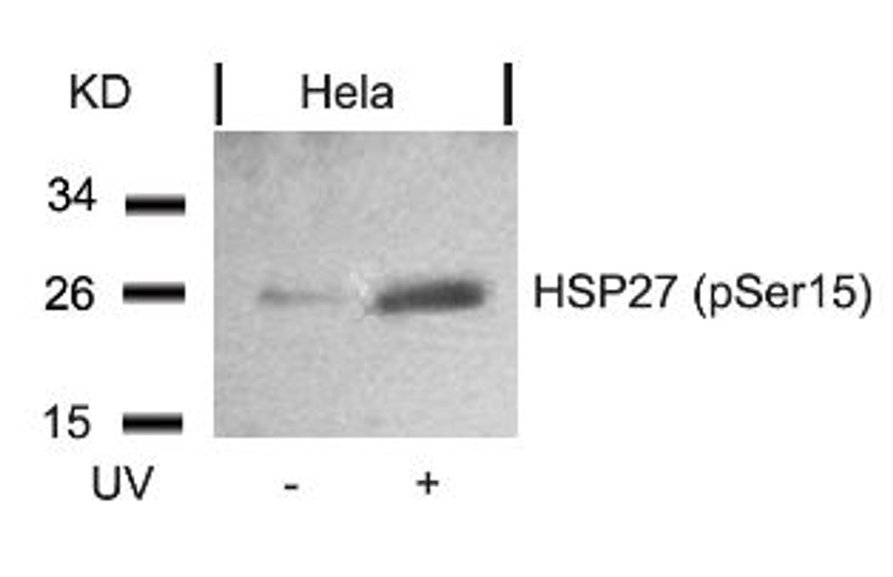 Western blot analysis of lysed extracts from HeLa cells untreated or treated with UV using HSP27 (Phospho-Ser15) .
