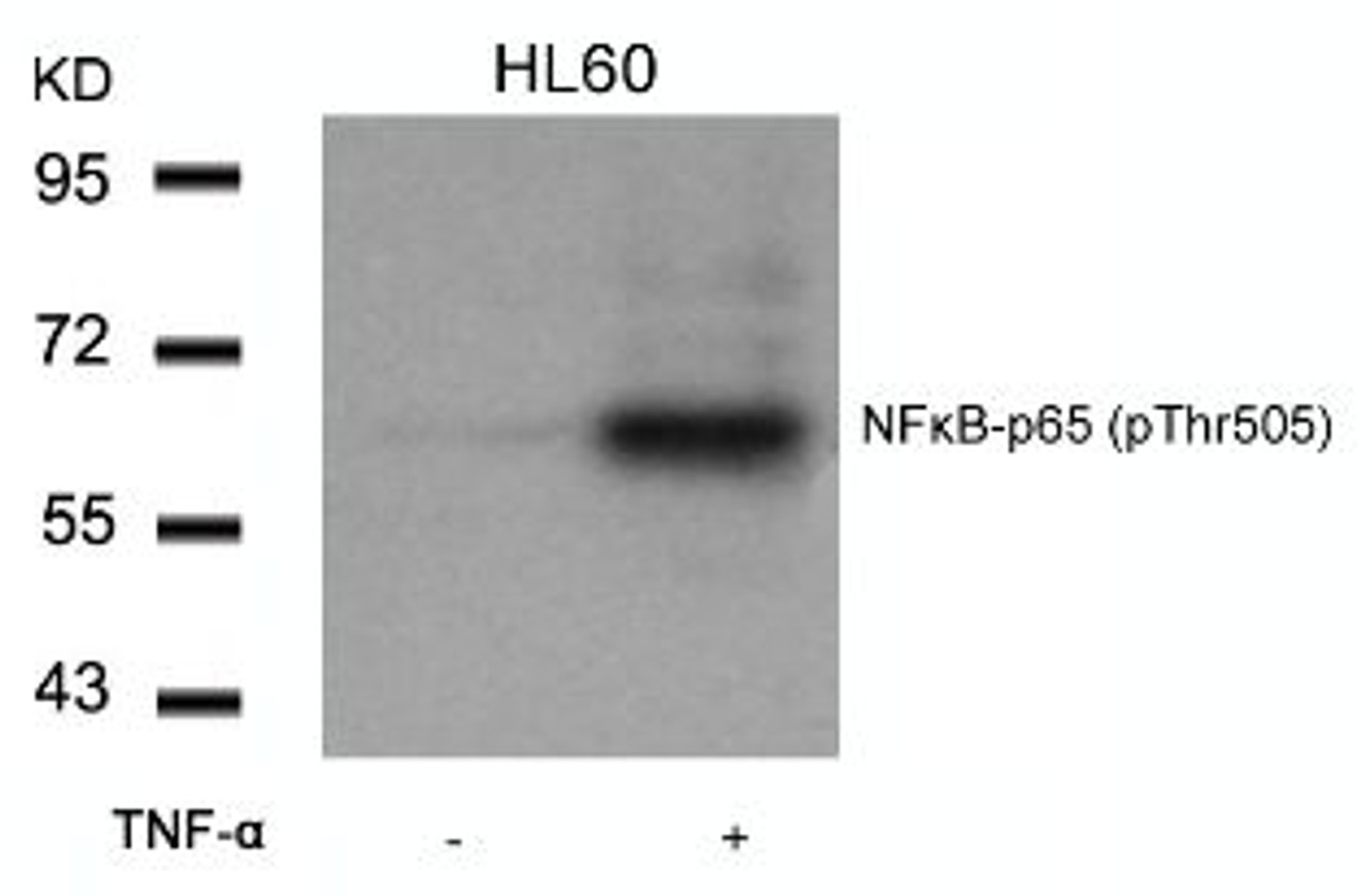 Western blot analysis of lysed extracts from HL60 cells untreated or treated with TNF-&#945; using NF&#954;B-p65 (Phospho-Thr505) .