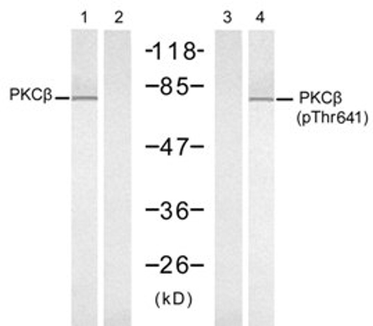 Western blot analysis of lysed extracts from K562 cells, untreated or treated with PMA (1 ng/mL, 10min) , using PKC, (Lane 1 and 2) and PKC, (Lane 3 and 4) .