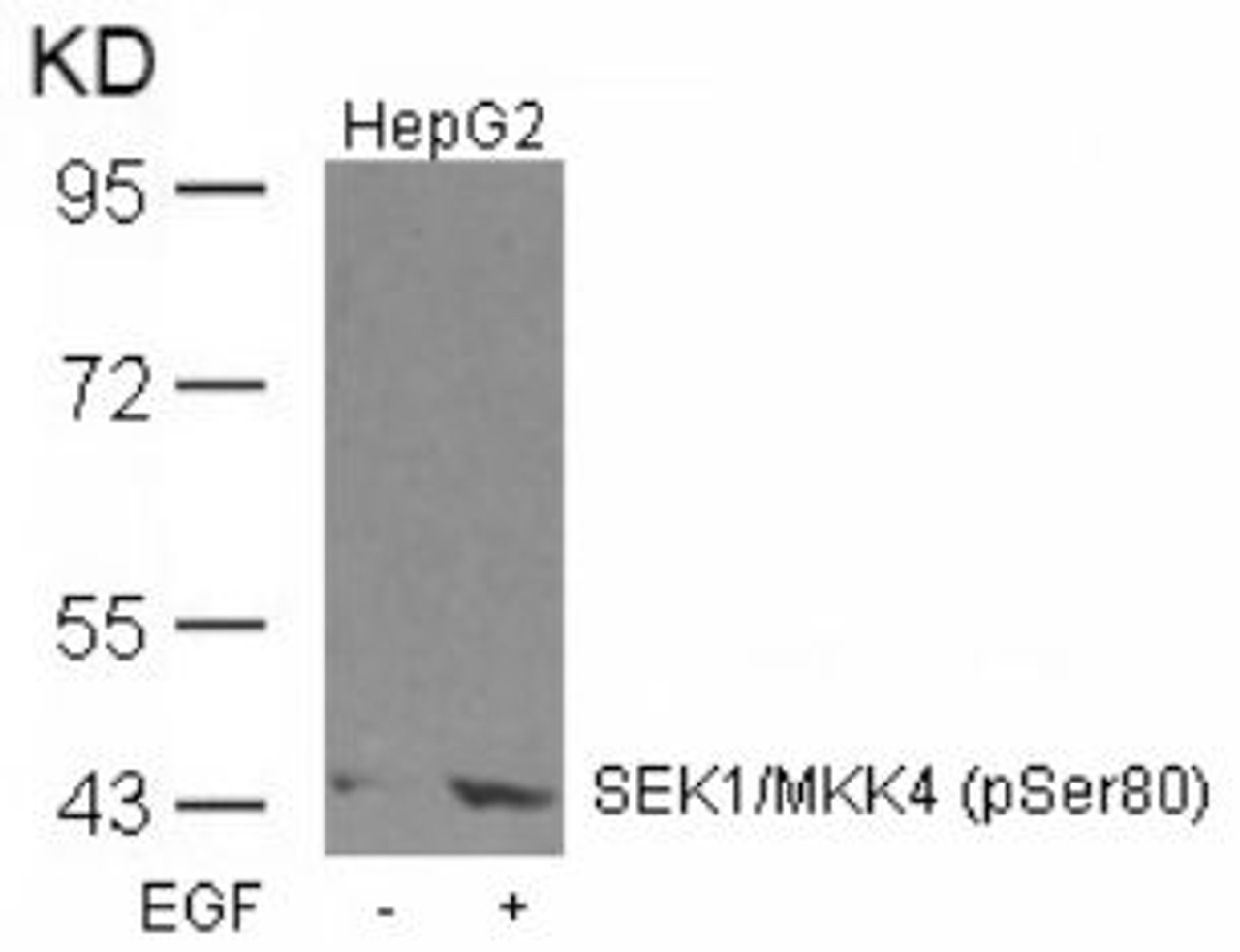 Western blot analysis of lysed extracts from HepG2 cells untreated or treated with EGF using SEK1/MKK4 (Phospho-Ser80) .