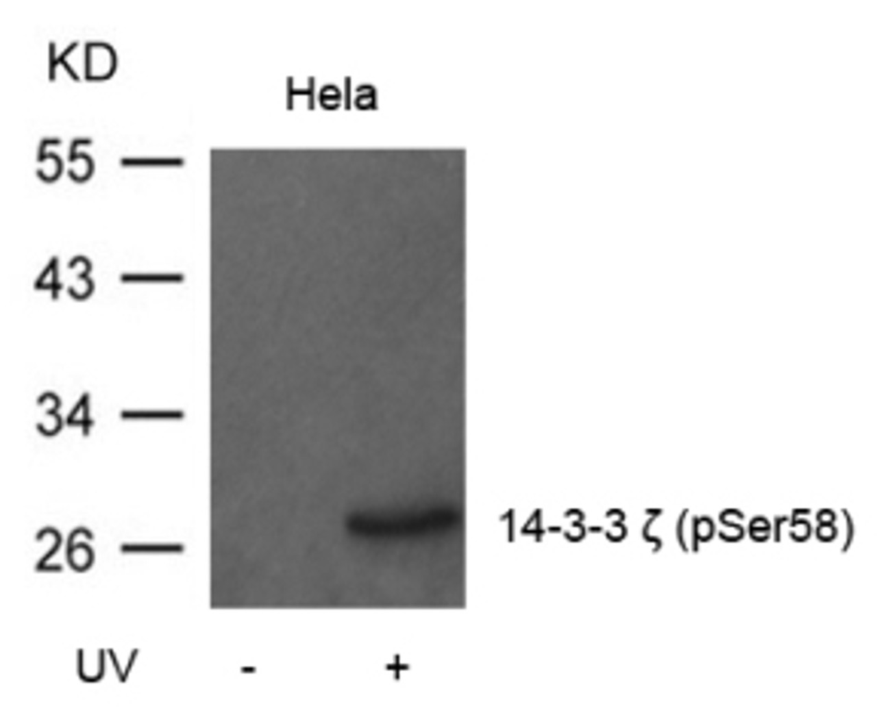 Western blot analysis of lysed extracts from HeLa cells untreated or treated with UV using 14-3-3 zeta (Phospho-Ser58) .