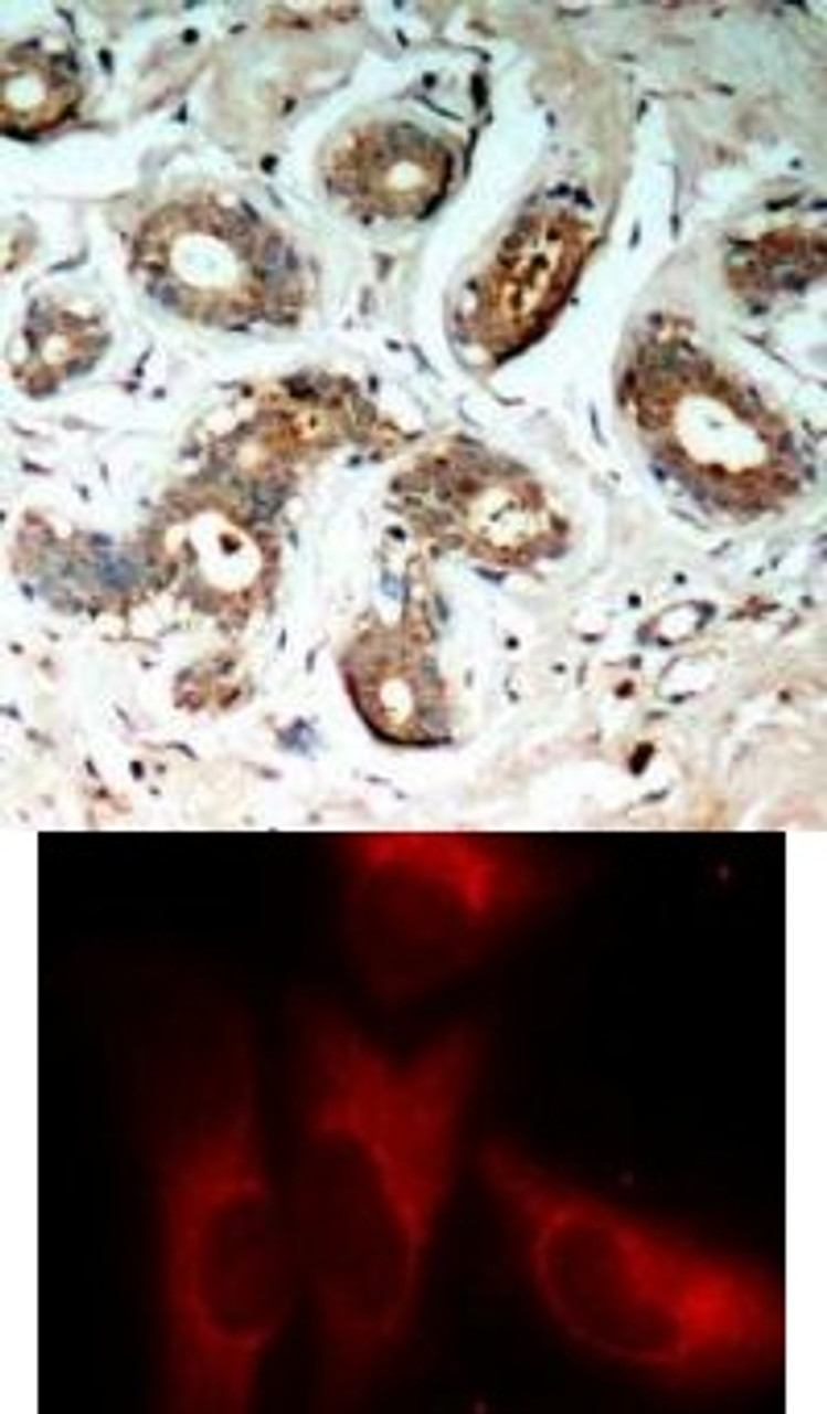 <b>Top Image:</b> Immunohistochemical analysis of paraffin-embedded human breast carcinoma tissue using 14-3-3 zeta (Phospho-Ser58) .<b>Bottom Image:</b> Immunofluorescence staining of methanol-fixed HeLa cells using 14-3-3 zeta (Phospho-Ser58) .