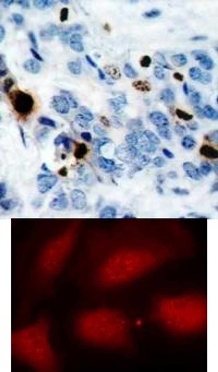 <b>Top Image:</b> Immunohistochemical analysis of paraffin-embedded human breast carcinoma tissue using Histone H3.1 (Phospho-Ser10) .<b>Bottom Image:</b> Immunofluorescence staining of methanol-fixed HeLa cells using Histone H3.1 (Phospho-Ser10) .
