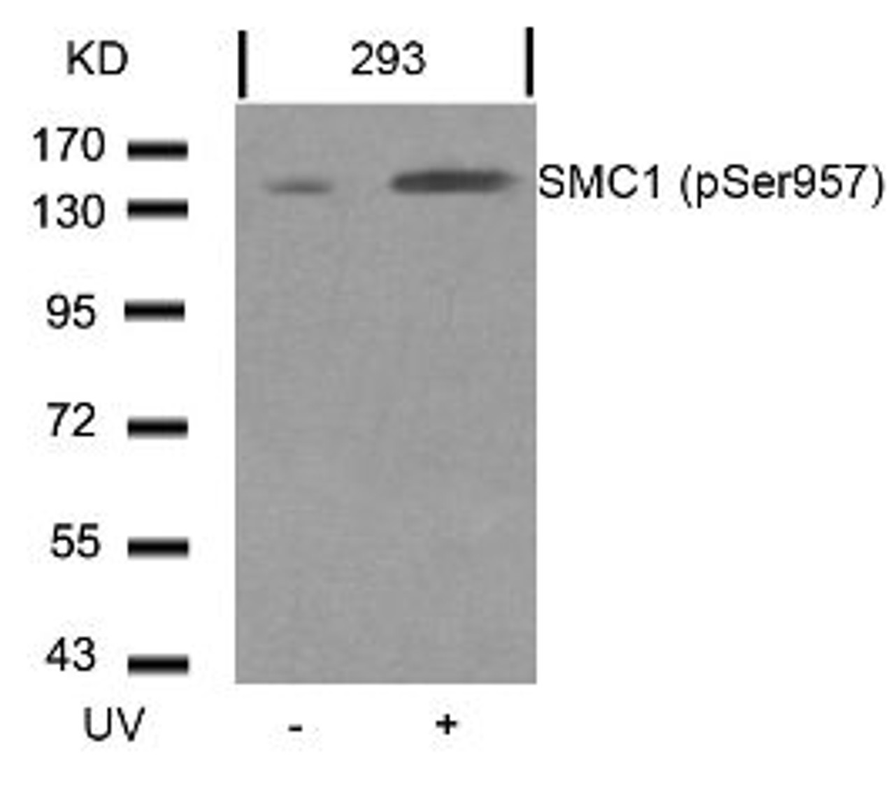 Western blot analysis of lysed extracts from 293 cells untreated or treated with UV using SMC1 (Phospho-Ser957) .