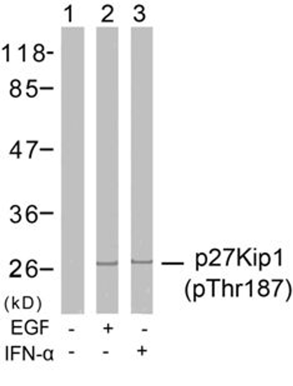 Western blot analysis of lysed extracts from HeLa cells untreated or treated with EGF, IFN-&#945; using p27Kip1 (Phospho-Thr187) .