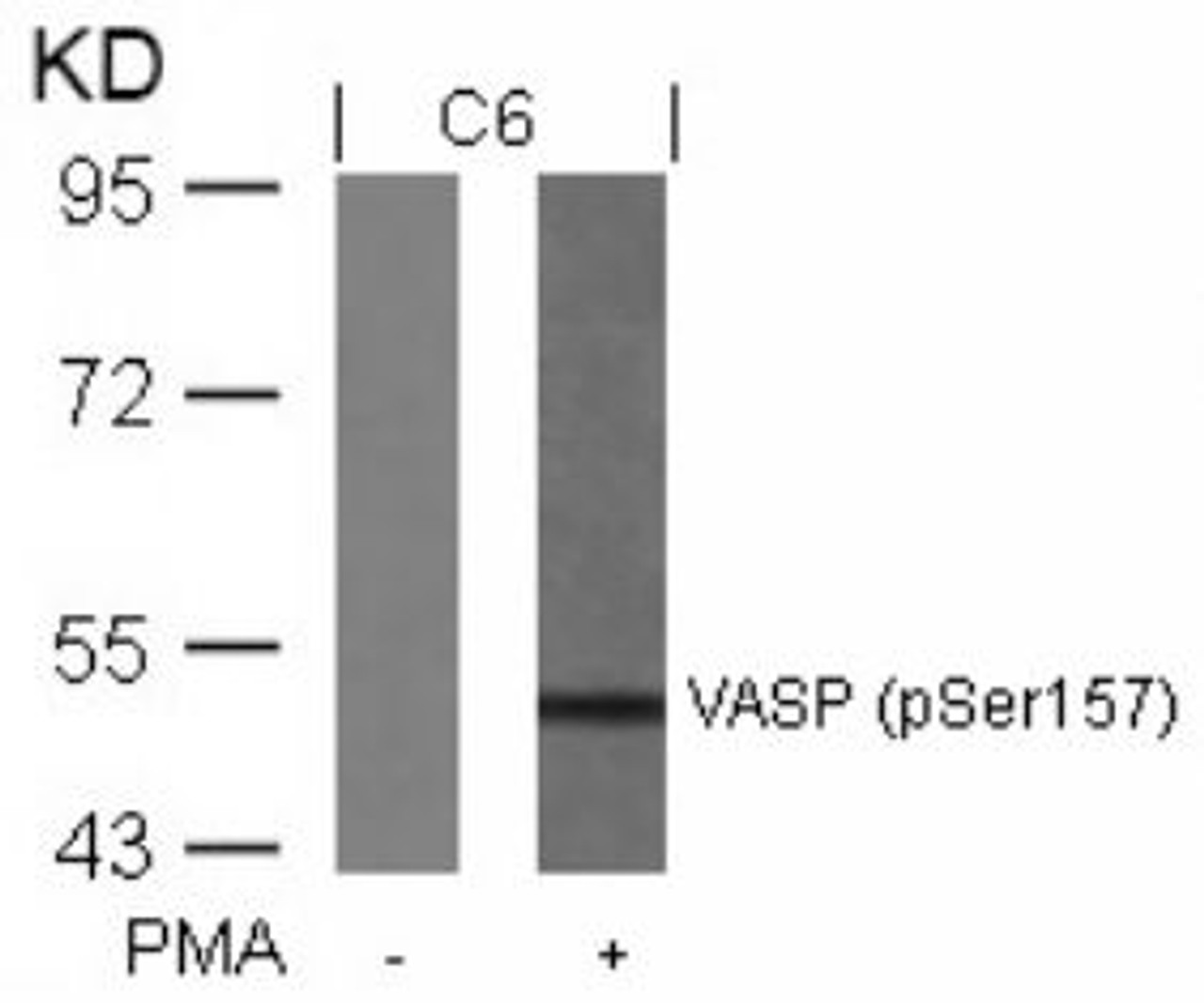 Western blot analysis of lysed extracts from C6 cells untreated or treated with PMA using VASP (Phospho-Ser157) .