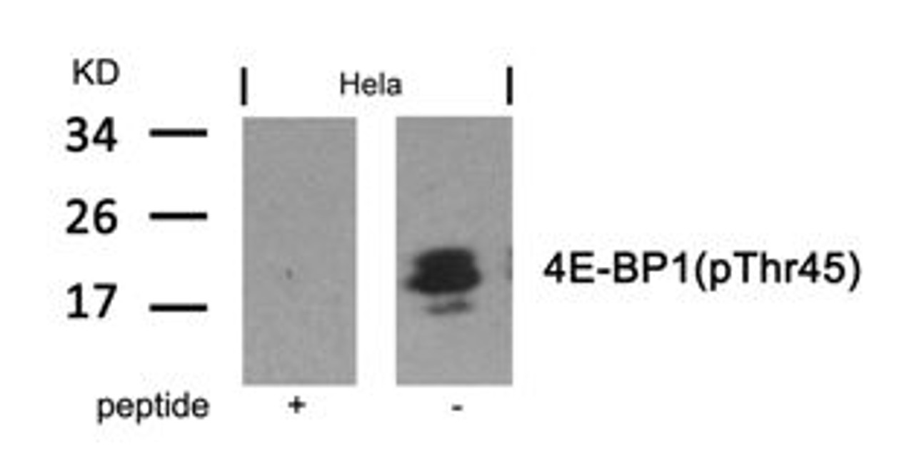 Western blot analysis of lysed extracts from HeLa cells using 4E-BP1 (Phospho-Thr45) .