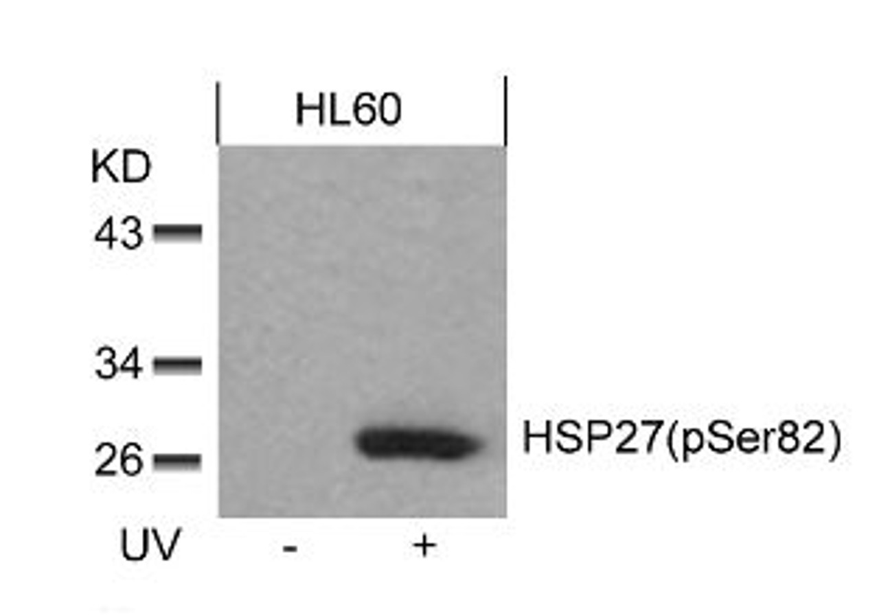Western blot analysis of lysed extracts from HL60 cells untreated or treated with UV using HSP27 (Phospho-Ser82) .