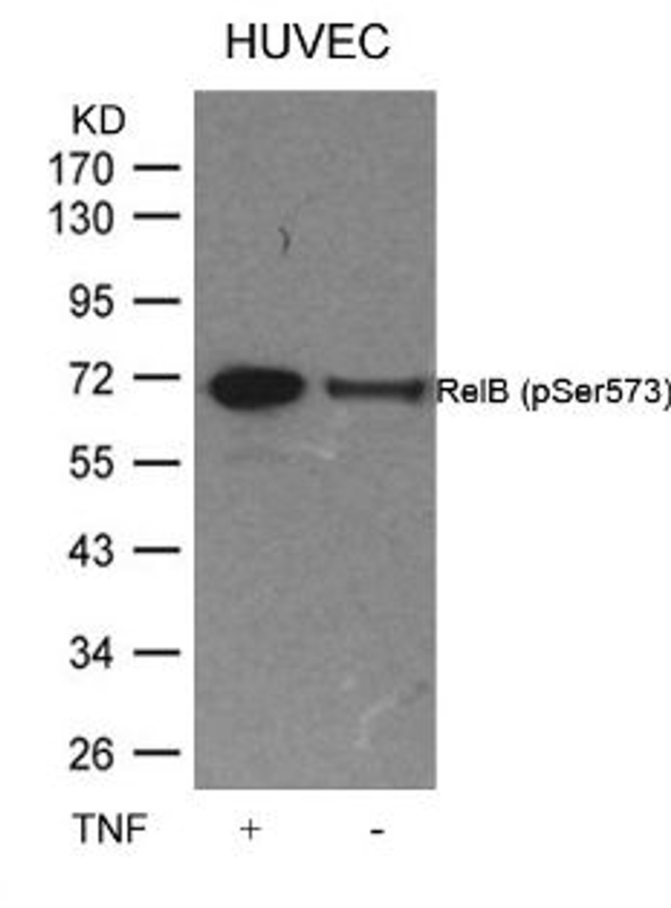 Western blot analysis of lysed extracts from HUVEC cells untreated or treated with TNF using RelB (Phospho-Ser573) .