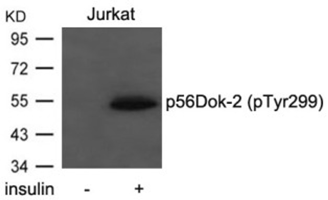 Western blot analysis of lysed extracts from Jurkat cells untreated or treated with insulin using p56Dok-2 (Phospho-Tyr299) .