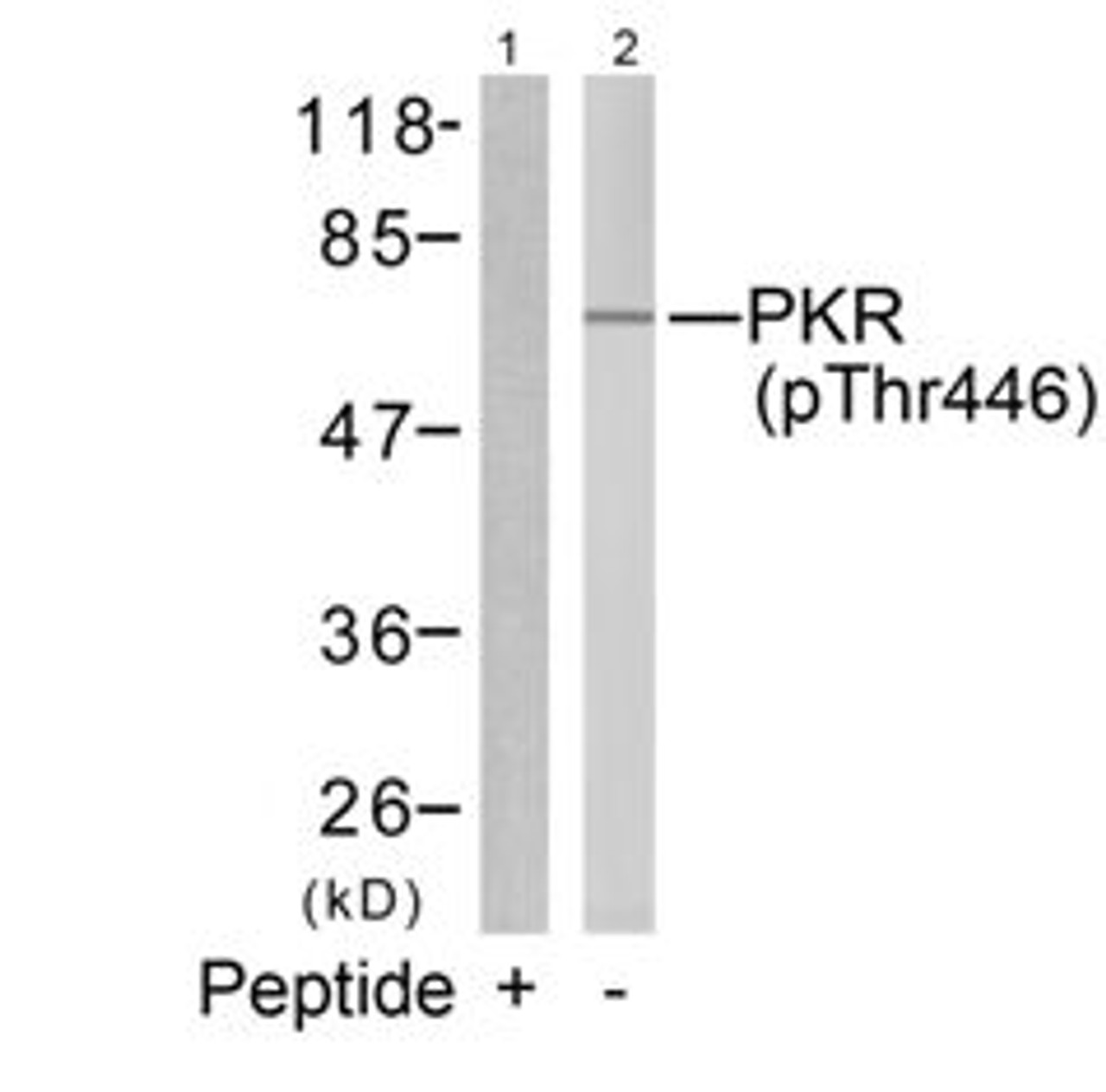 Western blot analysis of lysed extracts from K562 cells using PKR (Phospho-Thr446) .