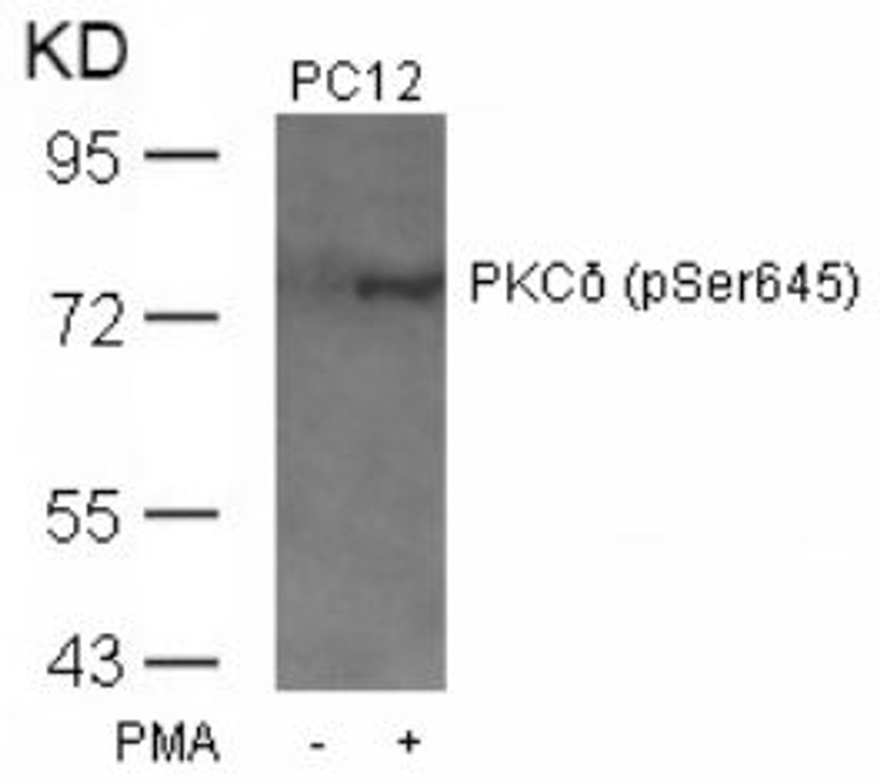 Western blot analysis of lysed extracts from PC12 cells untreated or treated with PMA using PKC&#948; (Phospho-Ser645) .