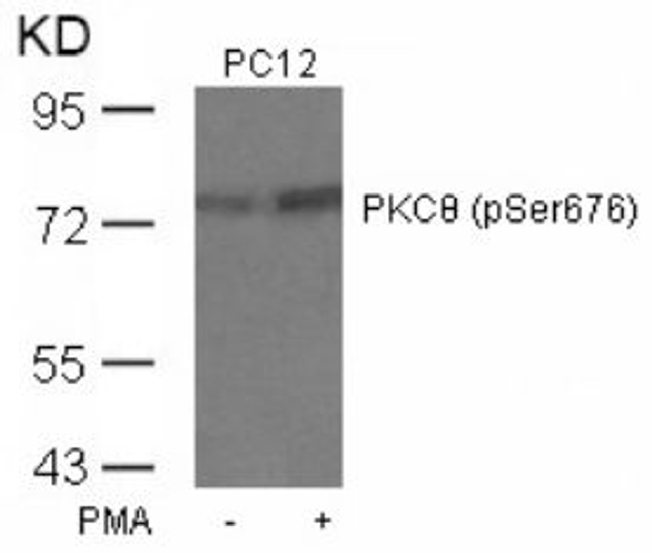 Western blot analysis of lysed extracts from PC12 cells untreated or treated with PMA using PKC&#920; (Phospho-Ser676) .