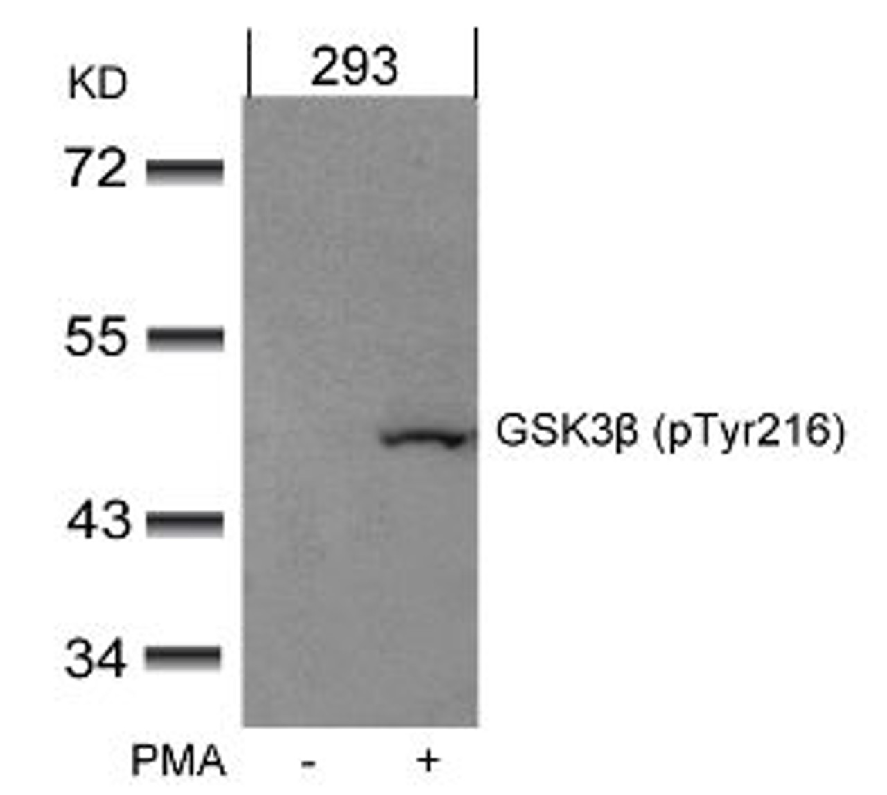 Western blot analysis of lysed extracts from 293 cells untreated or treated with PMA using GSK3&#946; (Phospho-Tyr216) .