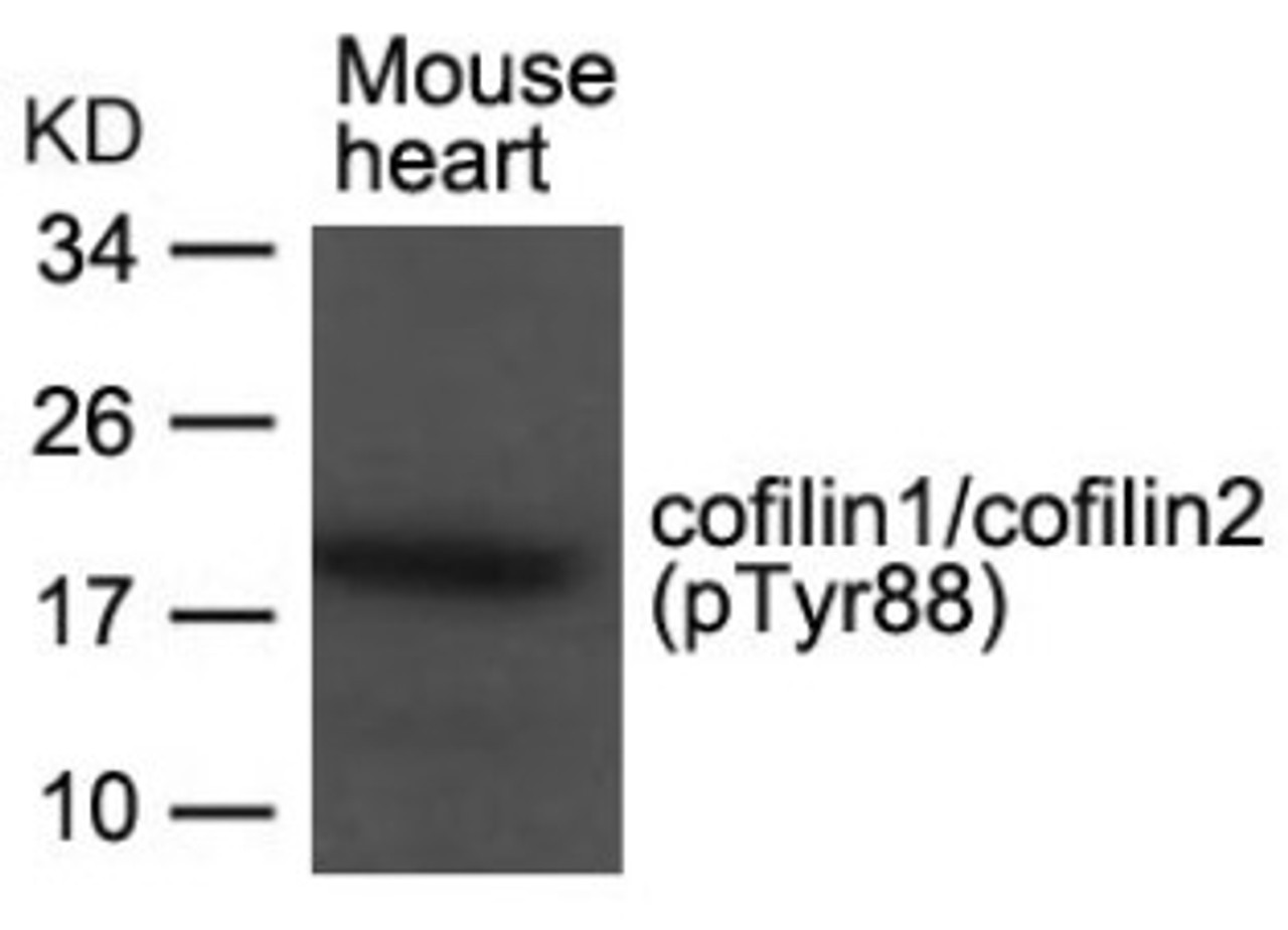 Western blot analysis of lysed extracts from Mouse heart tissue using cofilin1/cofilin2 (phospho-Tyr88) .