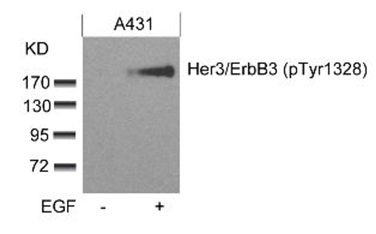 Western blot analysis of lysed extracts from A431 cells untreated or treated with EGF using Her3/ErbB3 (phospho-Tyr1328) .