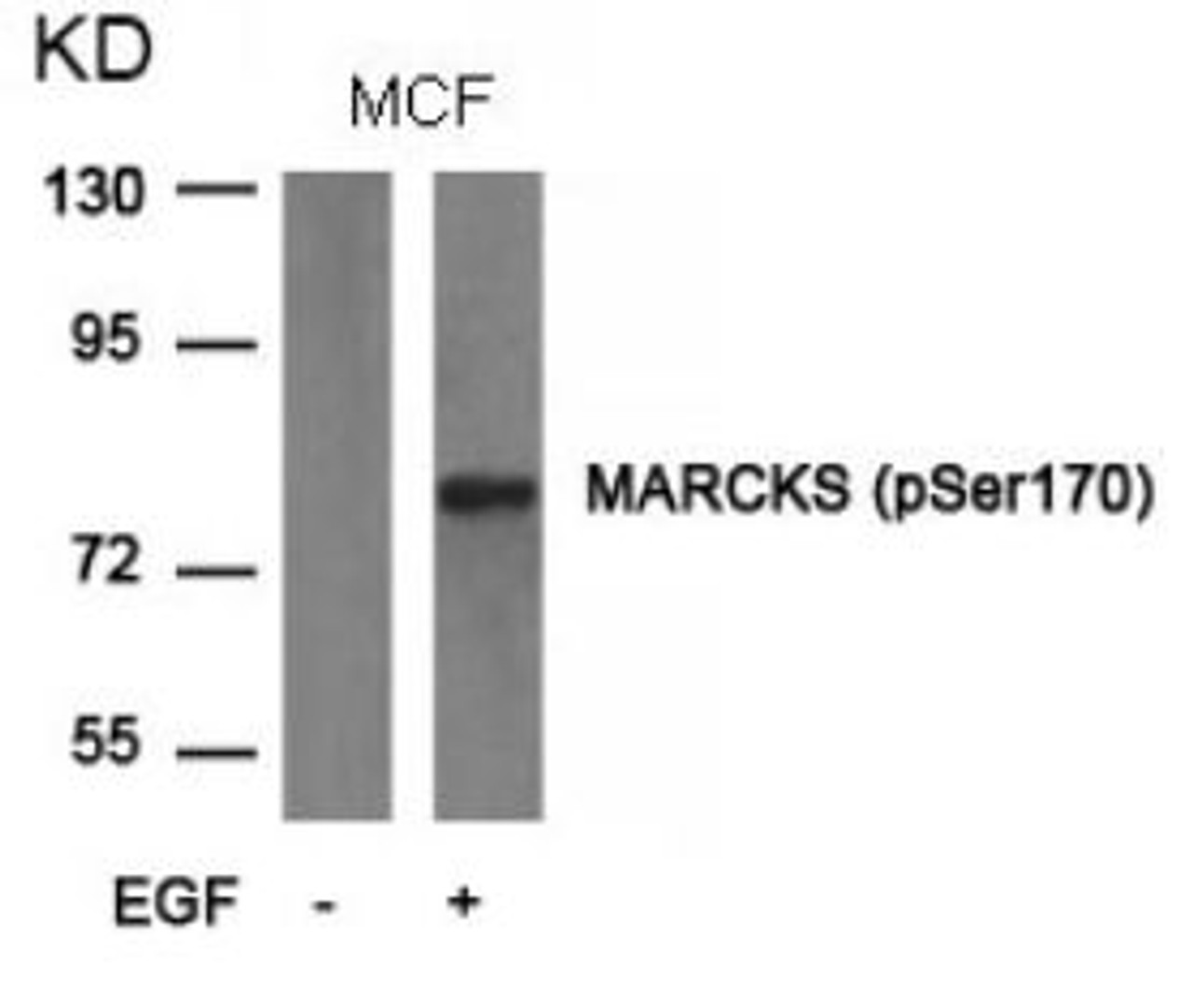 Western blot analysis of lysed extracts from MCF cells untreated or treated with EGF using MARCKS (phospho-Ser170) .