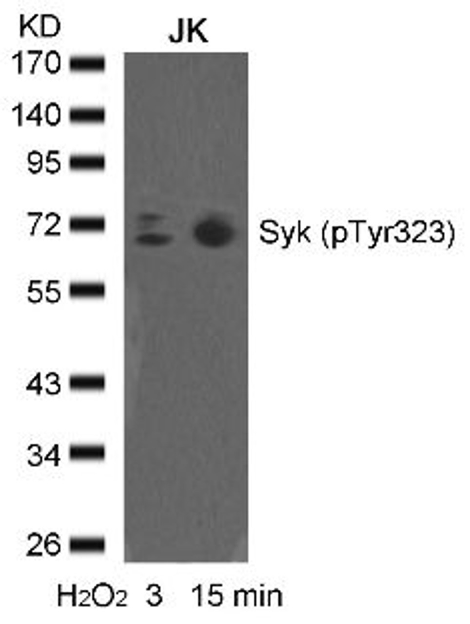 Western blot analysis of lysed extracts from JK cells untreated or treated with H2O2 for the indicated times, using syk (phospho-Tyr323) .