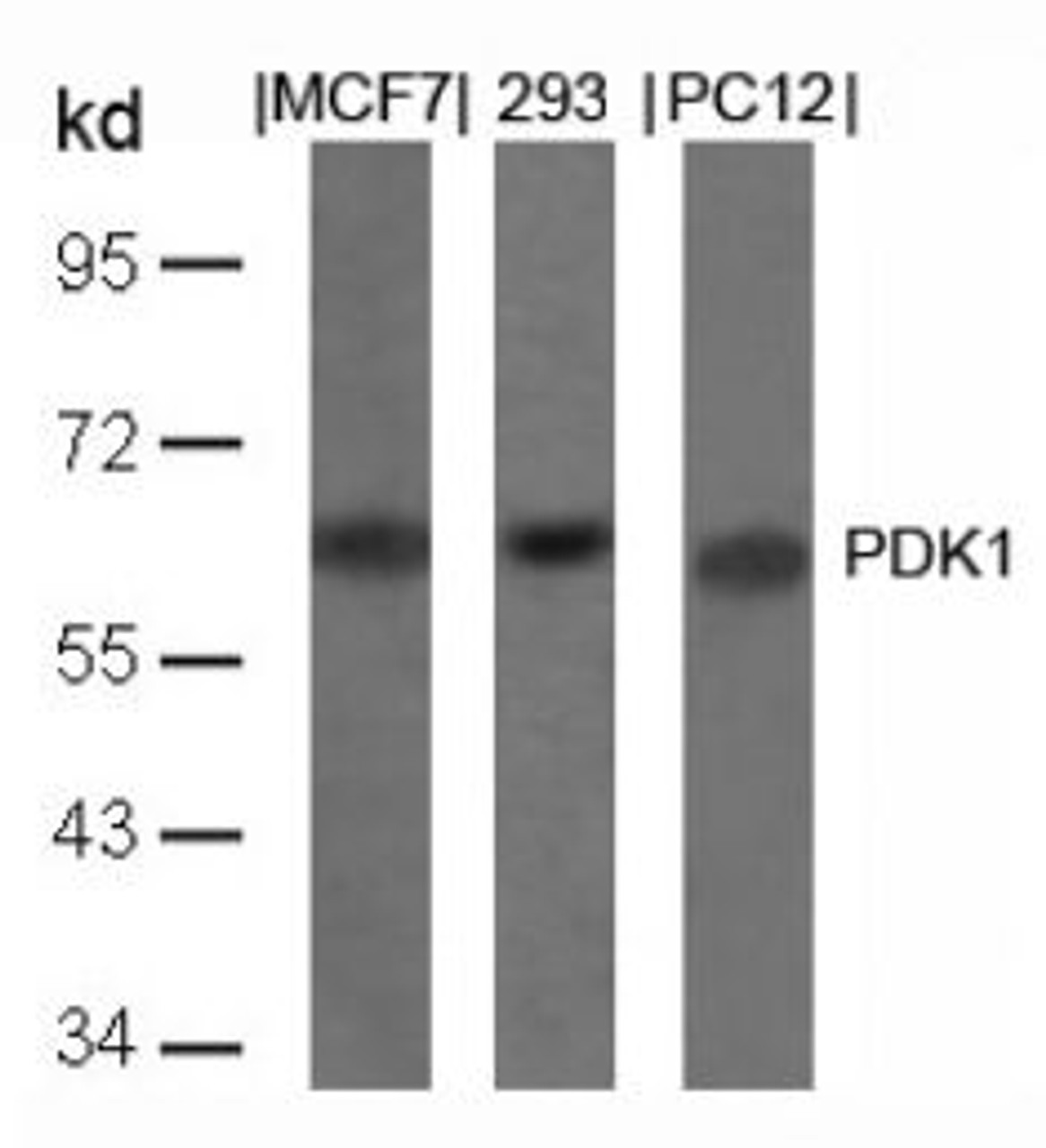 Western blot analysis of lysed extracts from MCF, 293 and PC12 cells using PDK1 (Ab-241) .