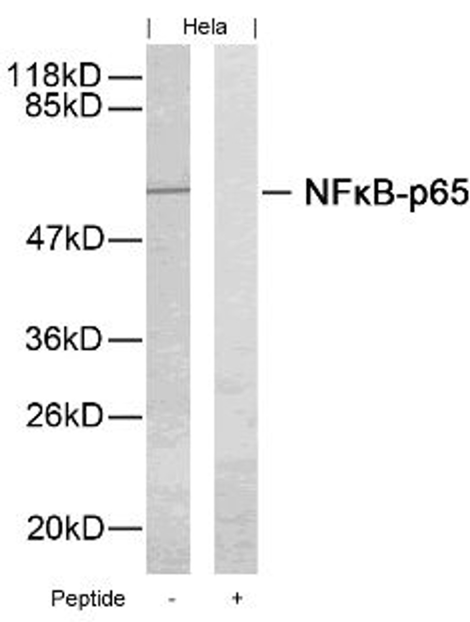 Western blot analysis of lysed extracts from HeLa cells using NF&#954;B-p65 (Ab-276) .