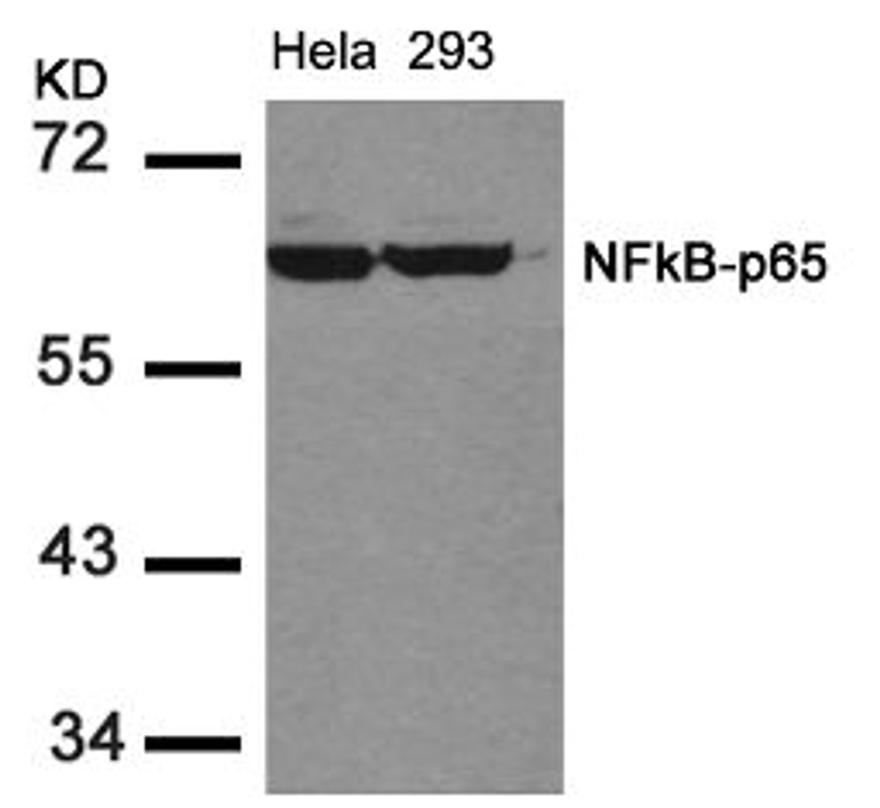 Western blot analysis of lysed extracts from HeLa and 293 cells using NF&#954;B-p65 (Ab-536) .