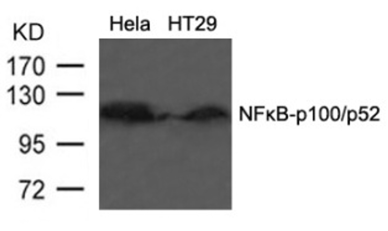 Western blot analysis of lysed extracts from HT29 cells using NF&#954;B-p100/p52 (Ab-866) .