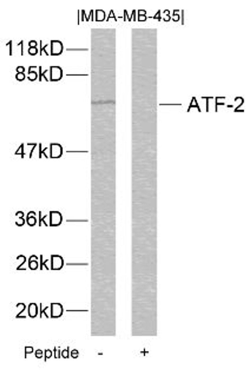Western blot analysis of lysed extracts from MDA-MB-435 cells using ATF2 (Ab-112 or 94) .