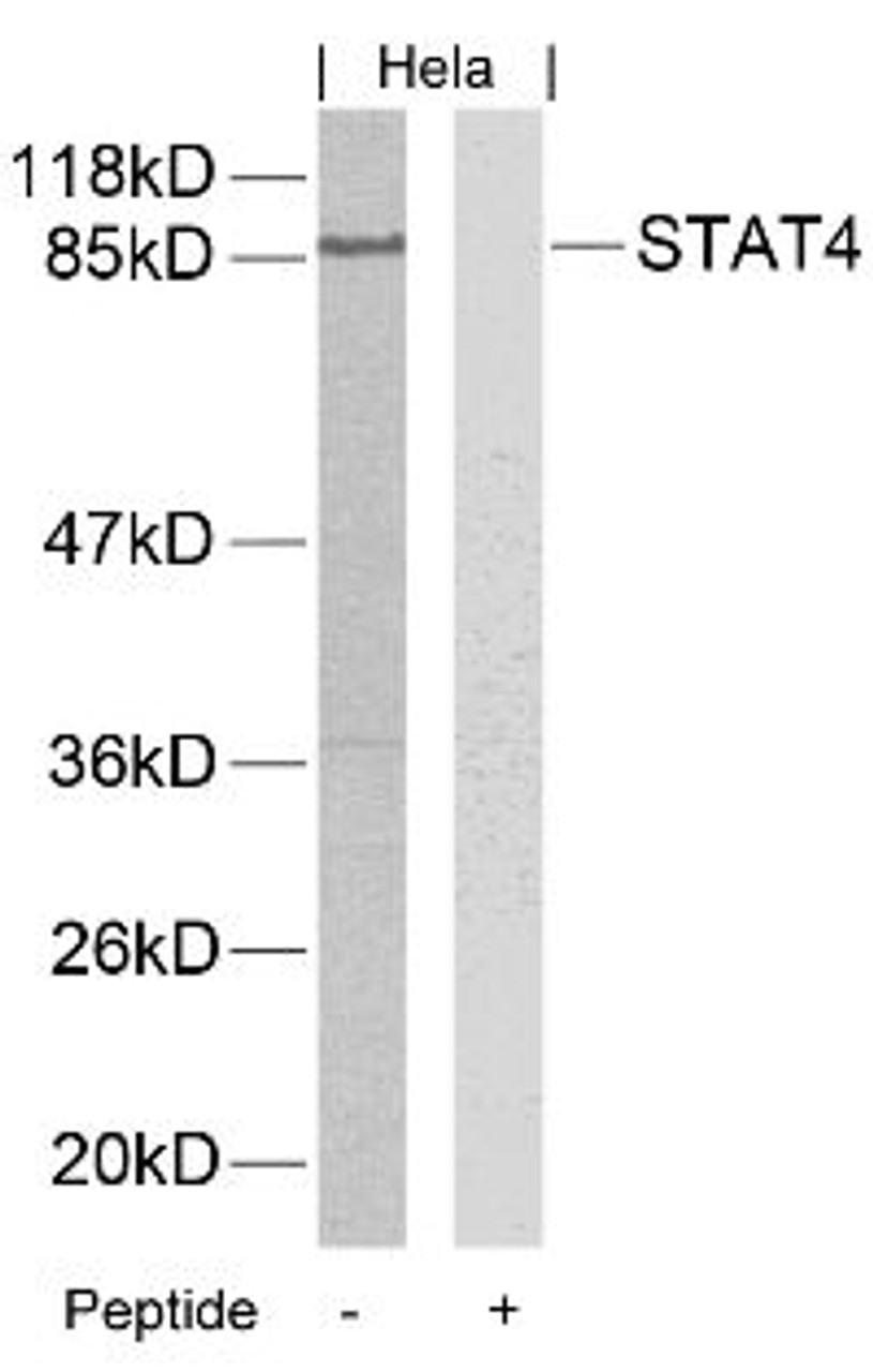 Western blot analysis of lysed extracts from HeLa, A431 and JK cells using STAT4 (Ab-693) .