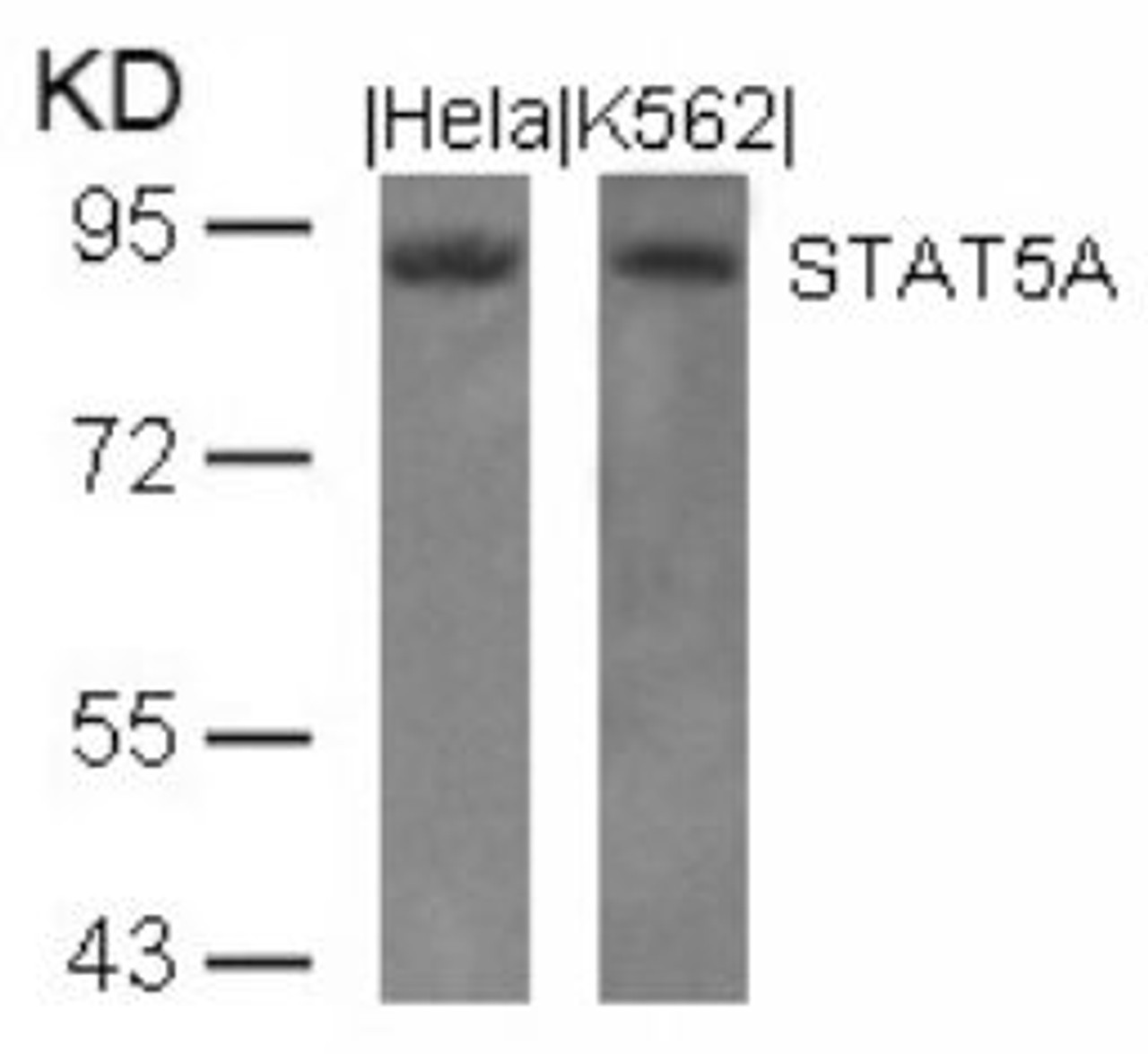 Western blot analysis of lysed extracts from HeLa and K562 cells using STAT5A (Ab-694) .