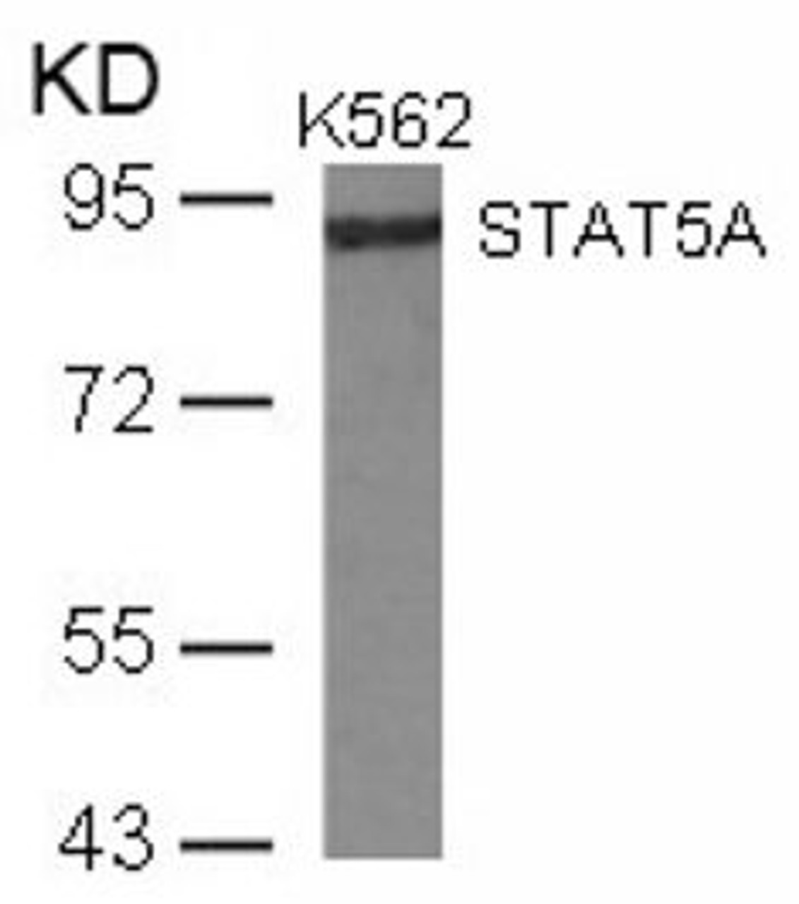 Western blot analysis of lysed extracts from K562 cells using STAT5A (Ab-780) .