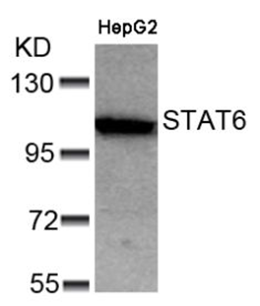 Western blot analysis of lysed extracts from HepG2 cells using STAT6 (Ab-641) .