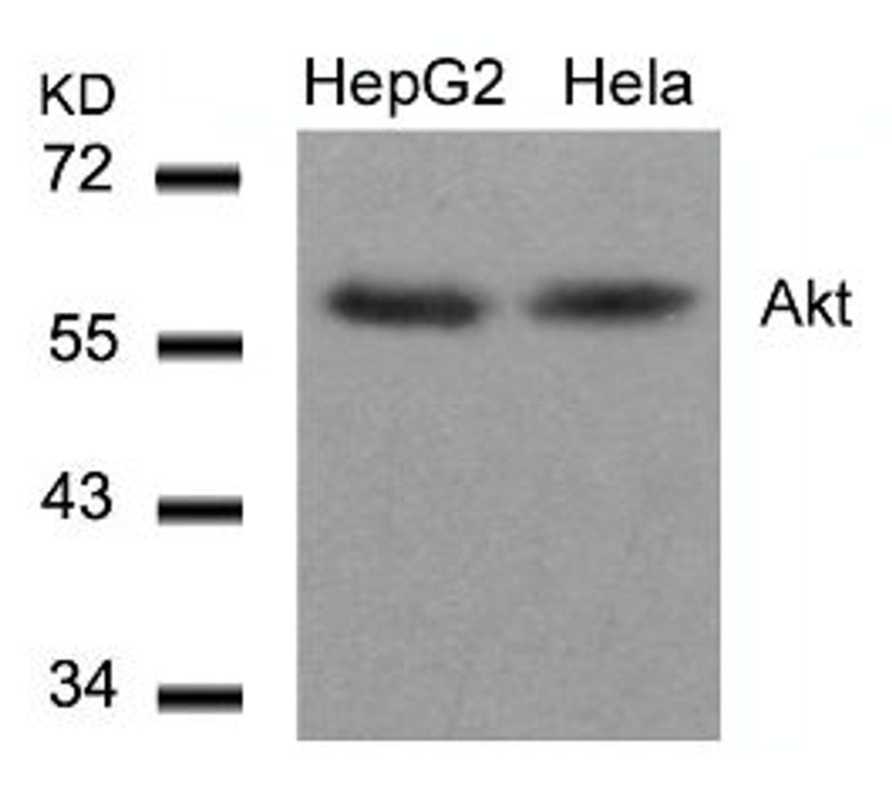 Western blot analysis of lysed extracts from HepG2 and HeLa cells using Akt (Ab-308) .