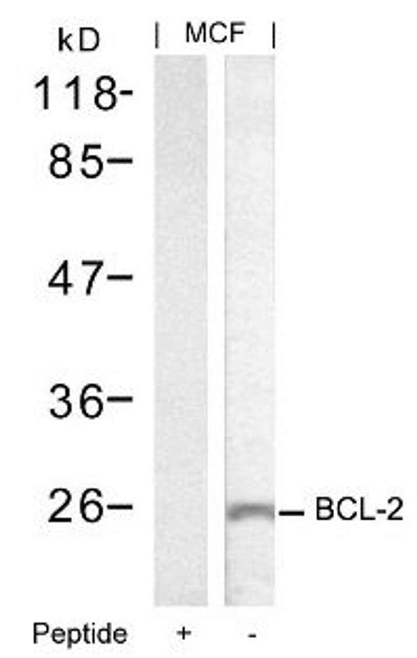 Western blot analysis of lysed extracts from MCF cells using BCL-2 (Ab-70) .