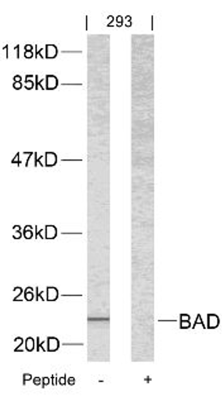 Western blot analysis of lysed extracts from 293 cells using BAD (Ab-112) .