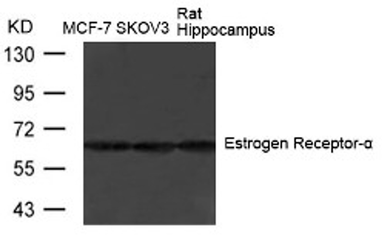 Western blot analysis of lysed extracts from MCF-7, SK-OV-3 cells and Rat hippocampus tissue using Estrogen Receptor-&#945; (Ab-104) .