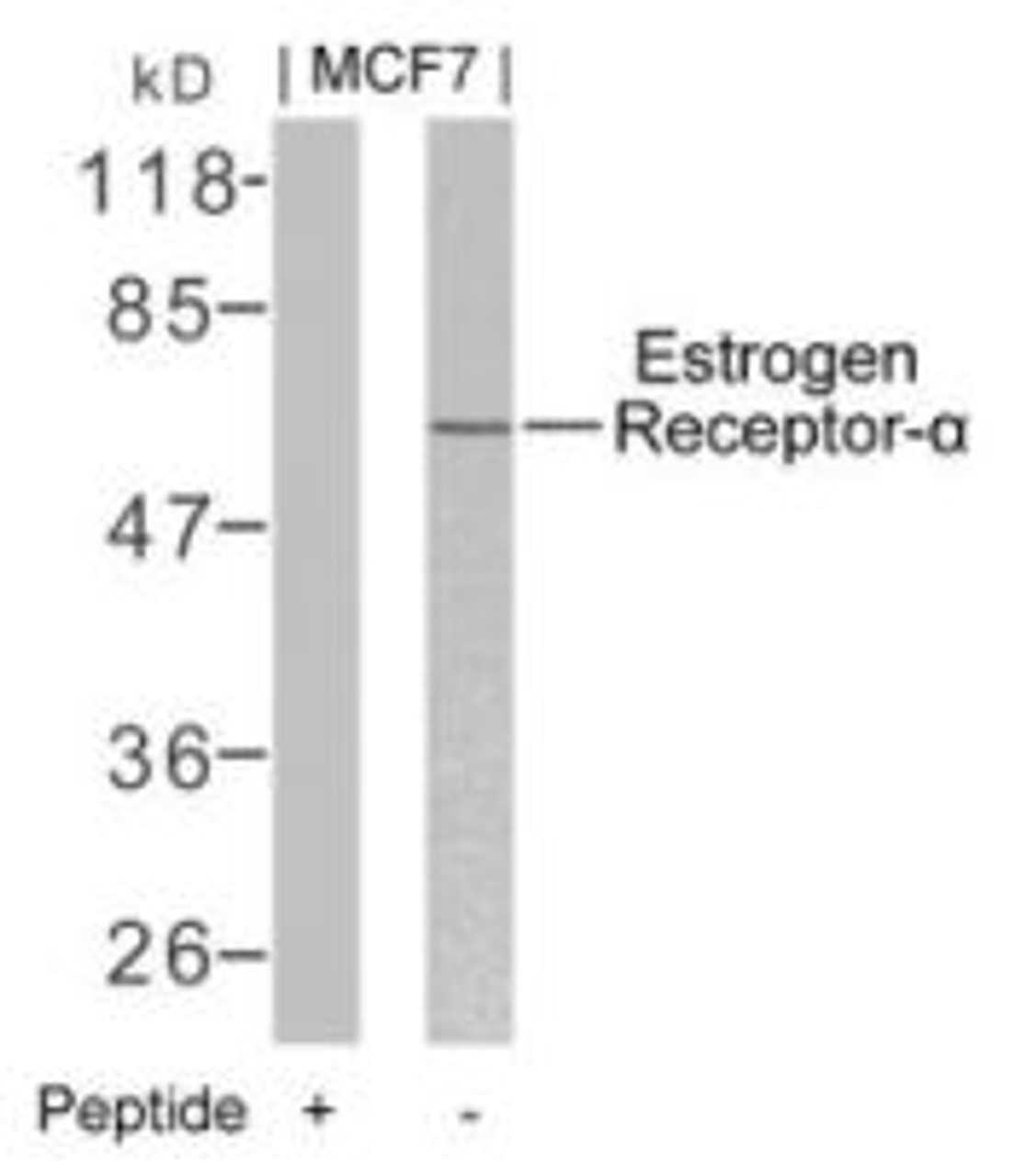 Western blot analysis of lysed extracts from MCF7 cells using Estrogen Receptor-&#945; (Ab-106) .