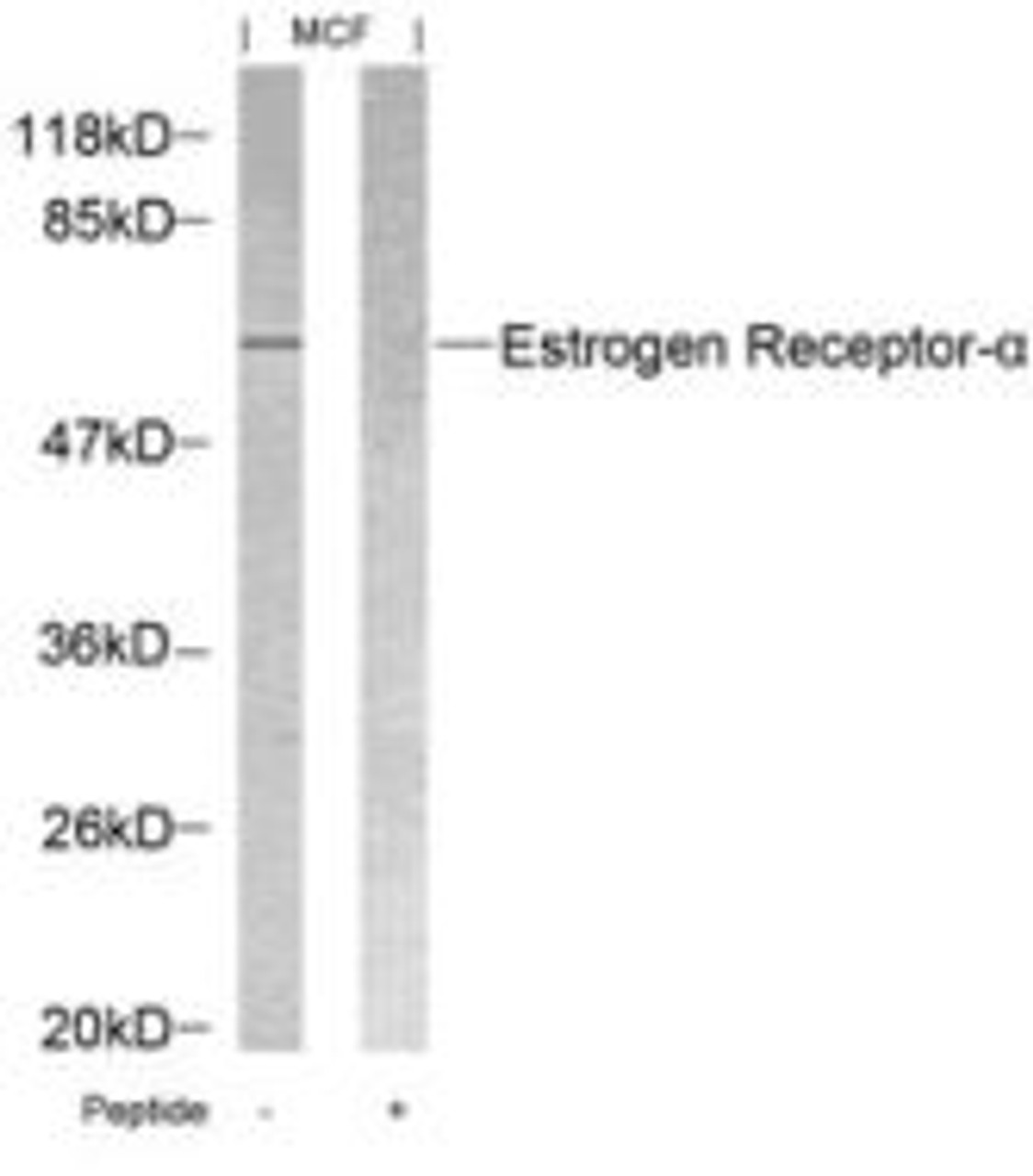 Western blot analysis of lysed extracts from MCF cells using Estrogen Receptor-&#945; (Ab-118) .