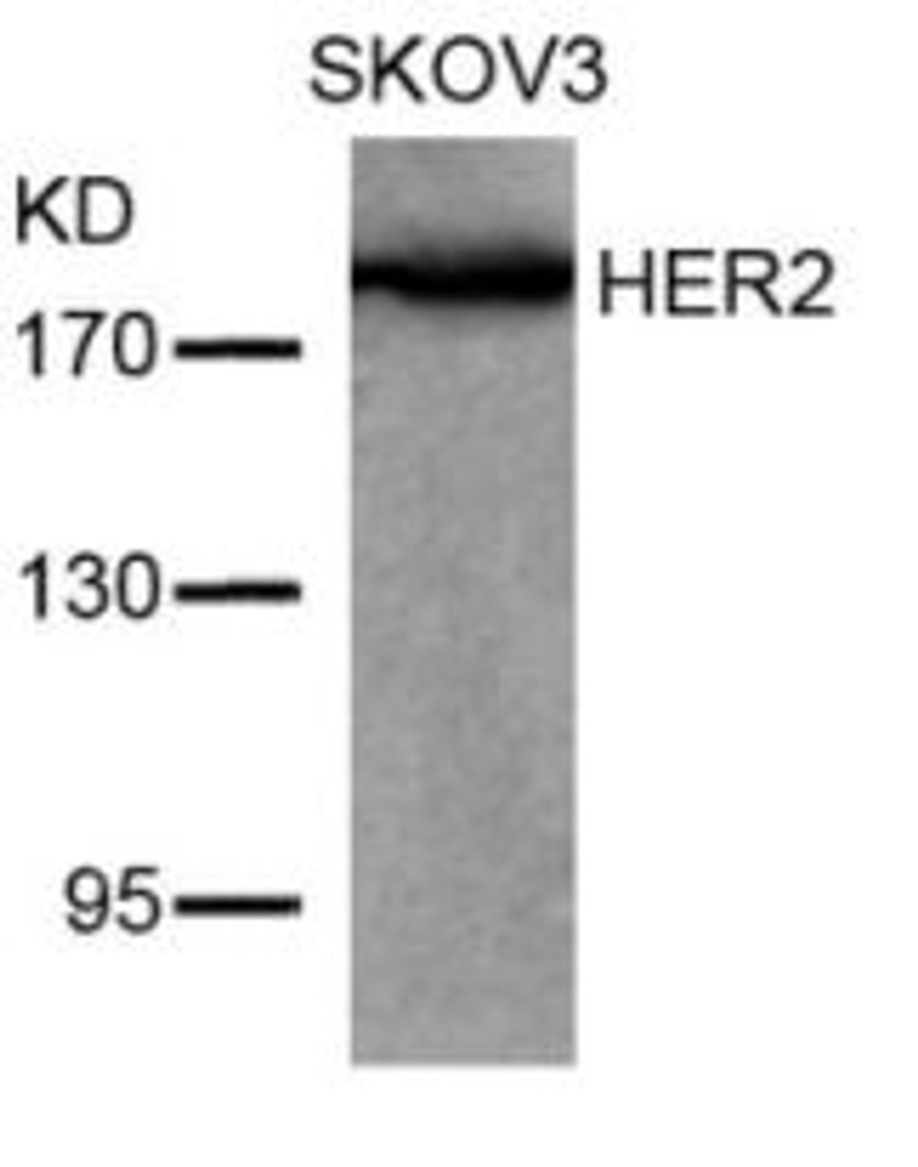 Western blot analysis of lysed extracts from SKOV3 cells using HER2 (Ab-877) .