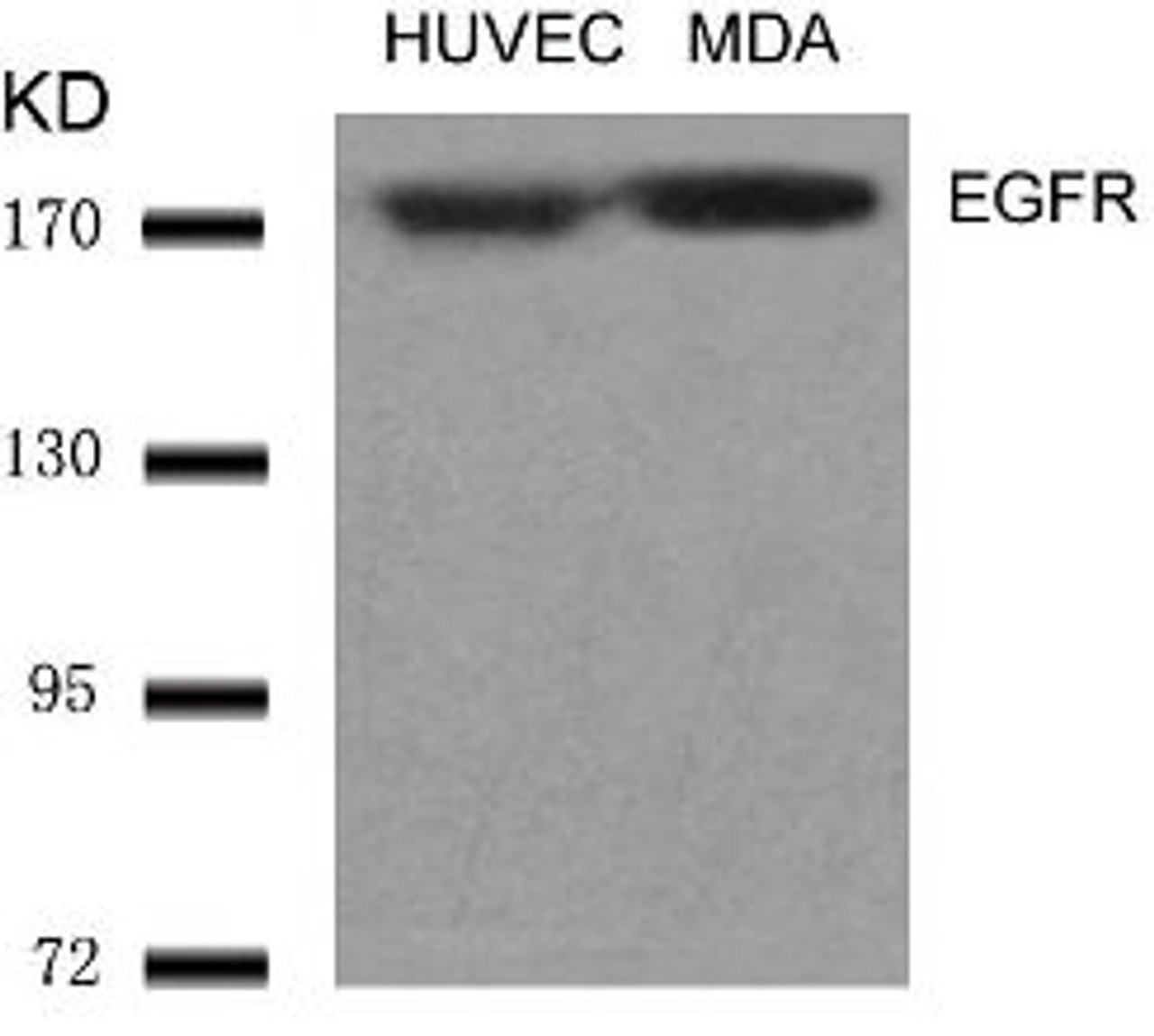 Western blot analysis of lysed extracts from HUVEC and MDA cells using EGFR (Ab-1070) .