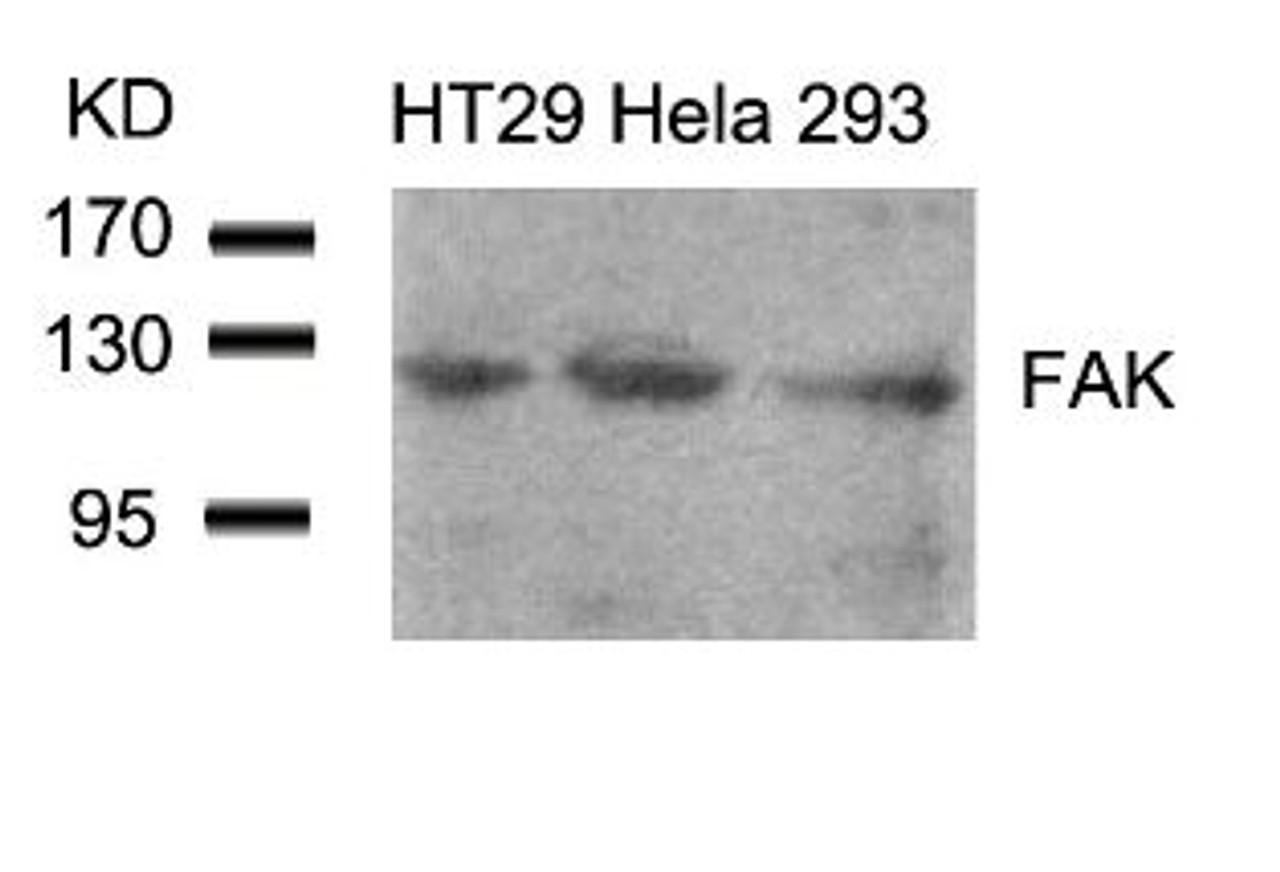 Western blot analysis of lysed extracts from HT29, HeLa and 293 cells using FAK (Ab-861) .