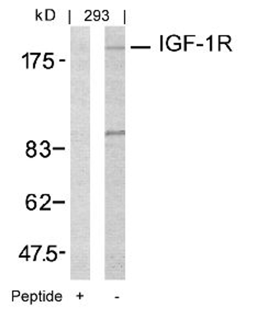 Western blot analysis of lysed extracts from 293 cells using IGF-1R (Ab-1161) .