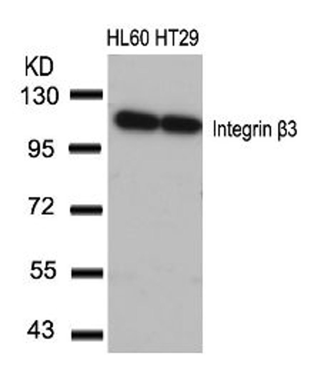 Western blot analysis of lysed extracts from HL60 and HT29 cells using Integrin &#946;3 (Ab-773) .