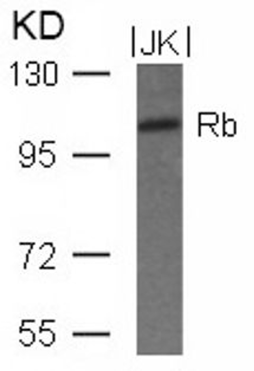 Western blot analysis of lysed extracts from JK cells using Rb (Ab-780) .
