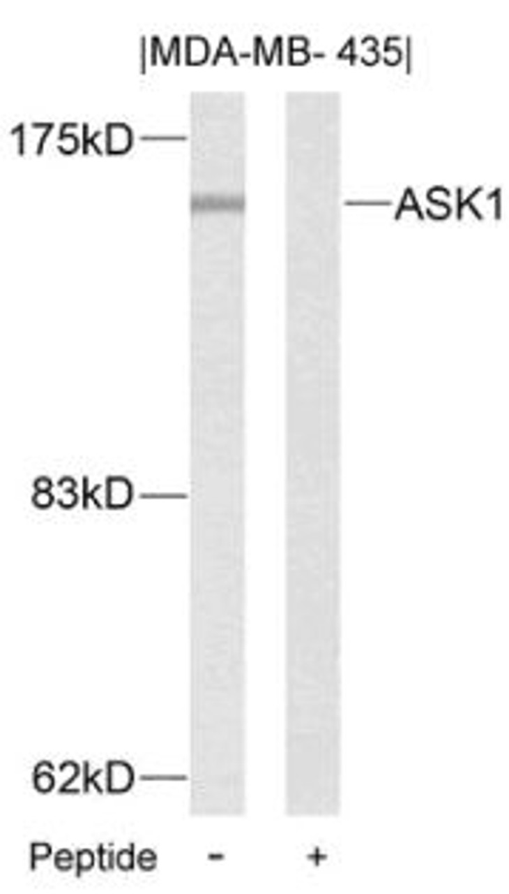 Western blot analysis of lysed extracts from MDA-MB- 435 cells using ASK1 (Ab-83) .