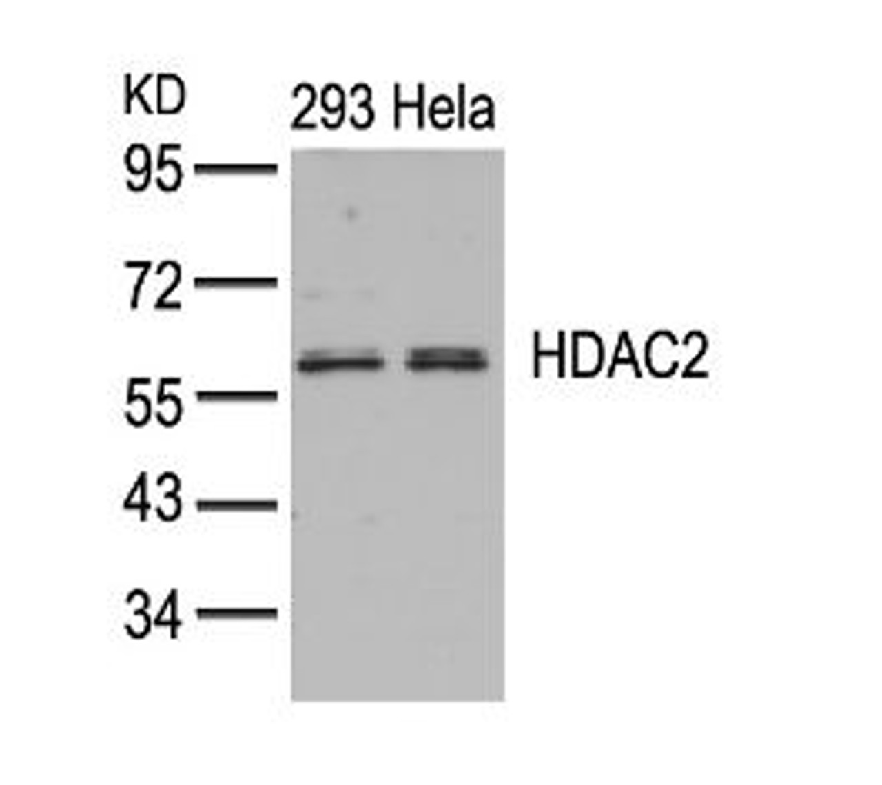 Western blot analysis of lysed extracts from 293 and HeLa cells using HDAC2 (Ab-394) .