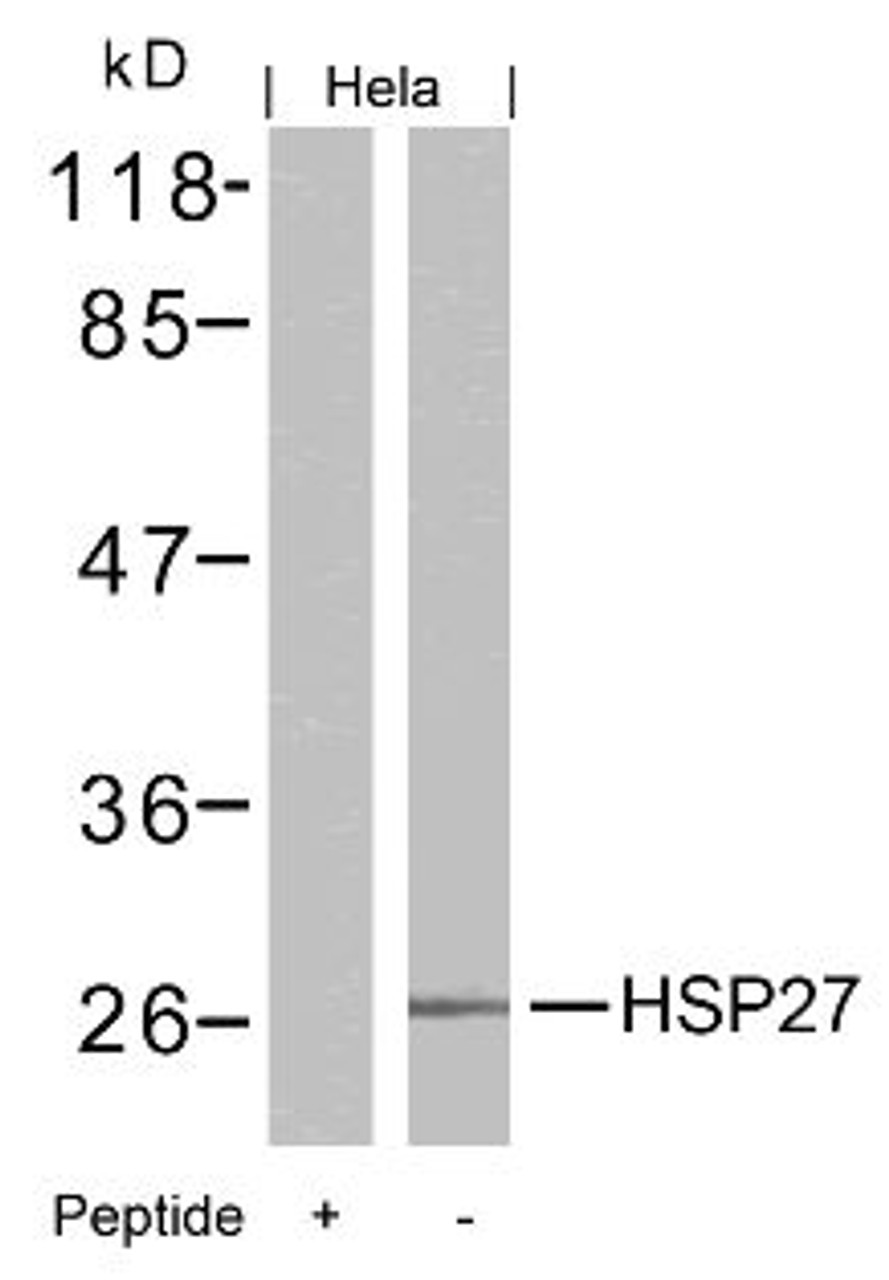 Western blot analysis of lysed extracts from HeLa cells using HSP27 (Ab-15) .