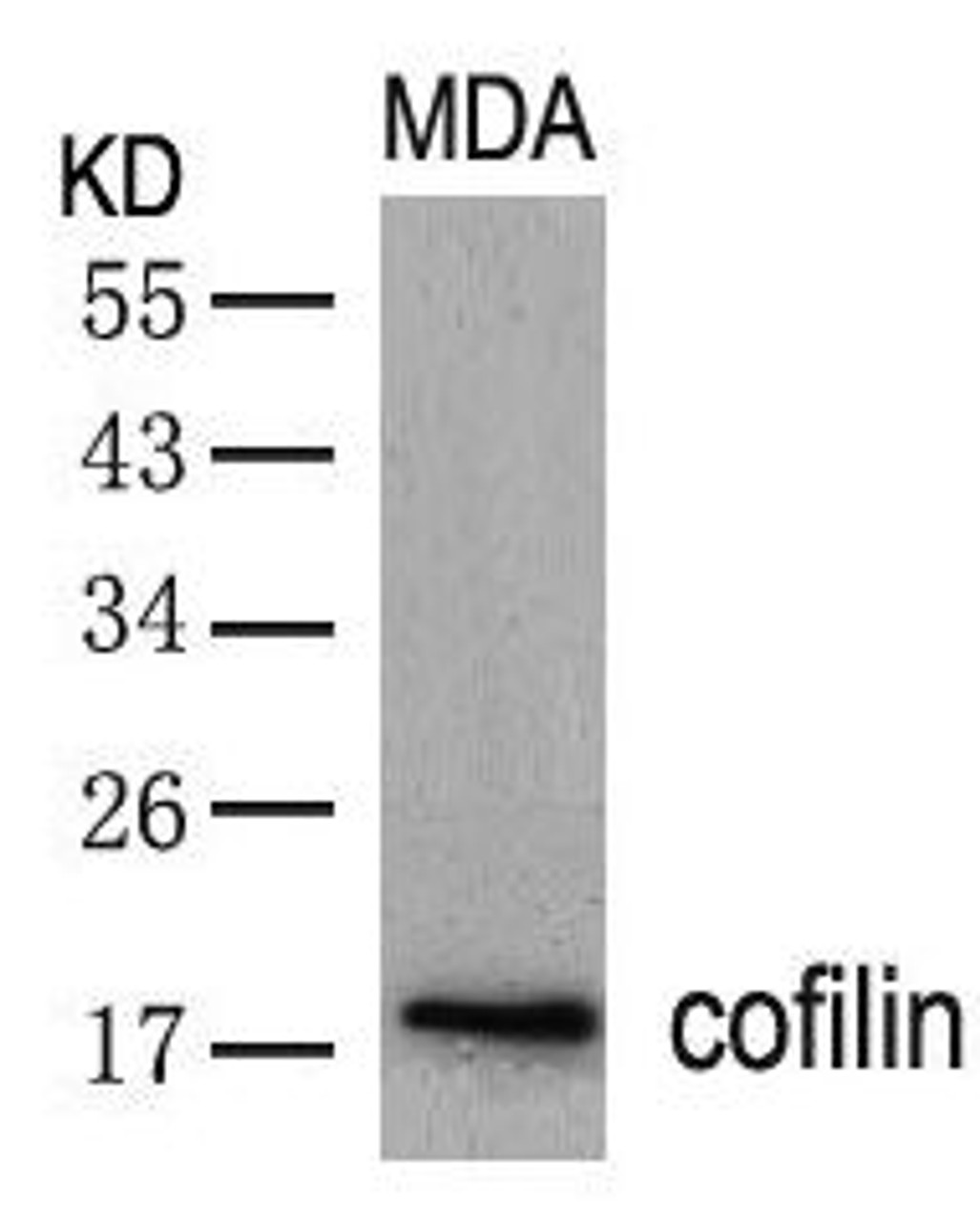 Western blot analysis of lysed extracts from MDA cells using cofilin (Ab-3) .
